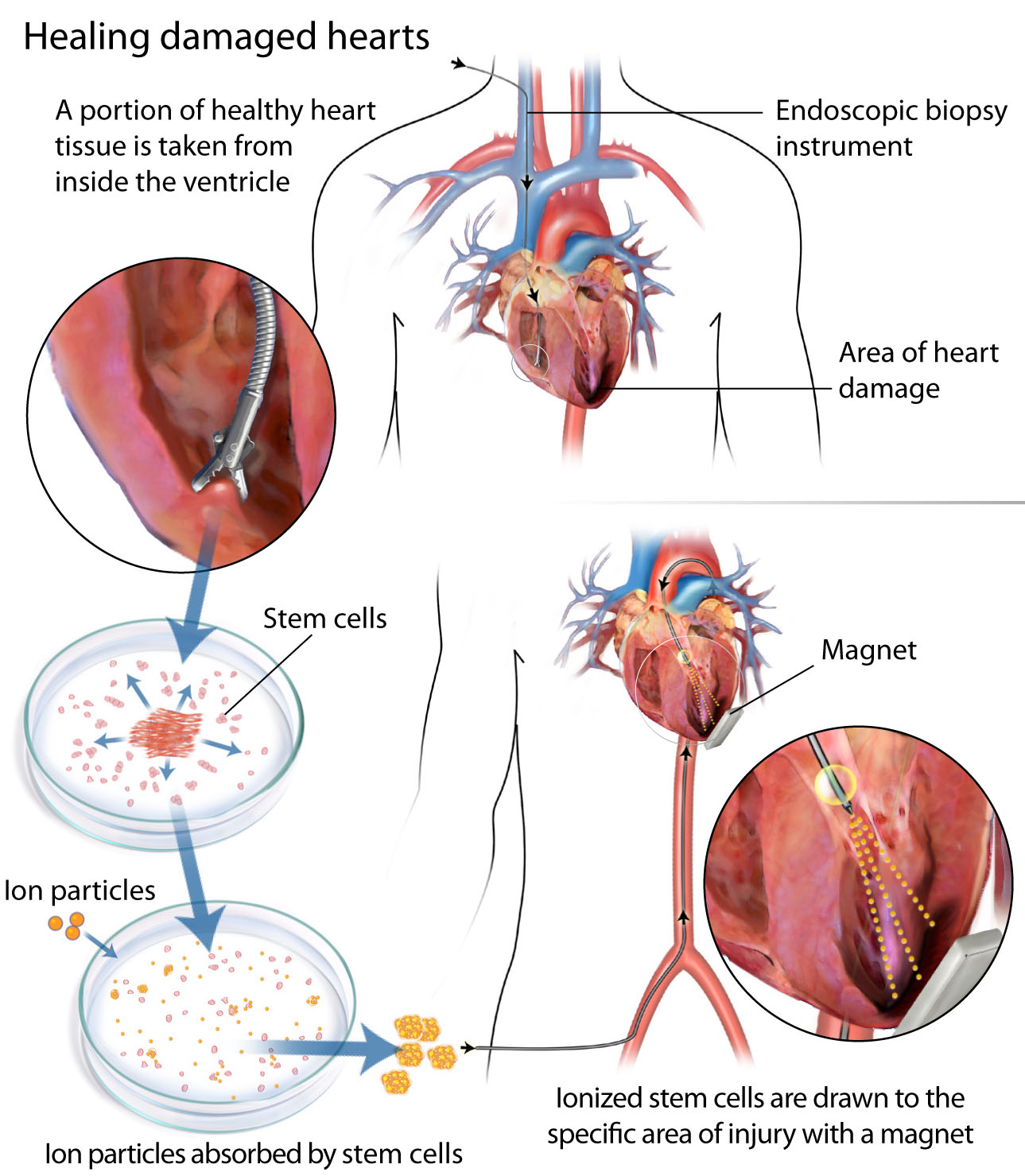Magnetized Cardiac Stem Cells Diagram