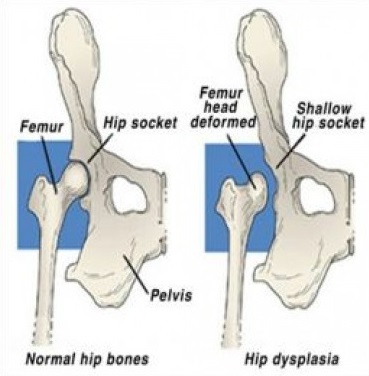 Canine Hip Dsyplasia Comparison