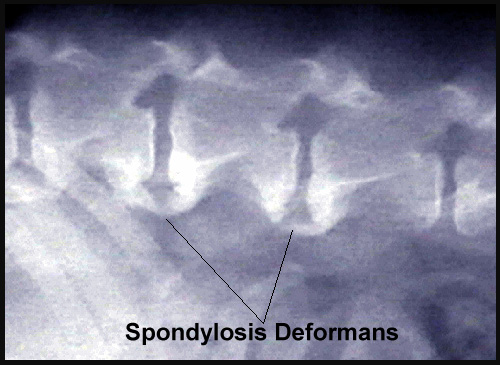 Spondylosis Deformans 