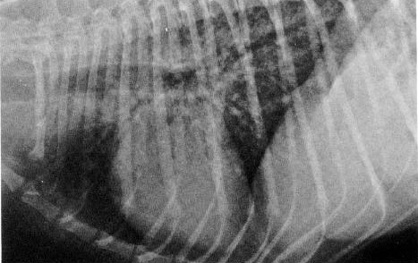 Pneumocystis x-ray