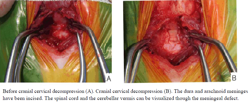 Figure 2 - Before and After