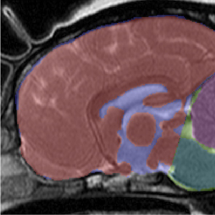 CKCS Forebrain