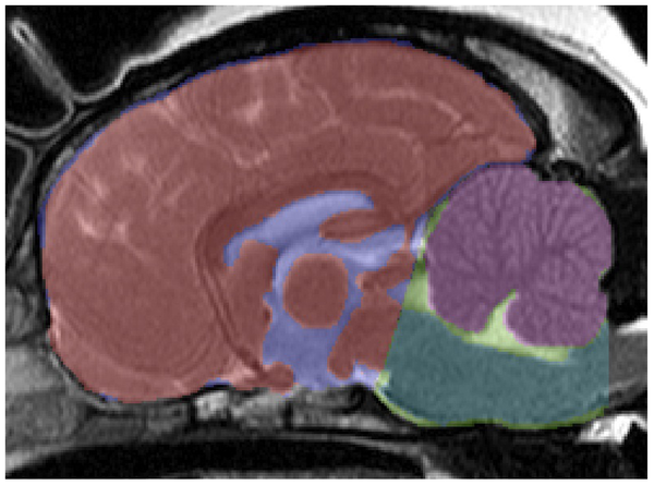 MRI from April 2012 study