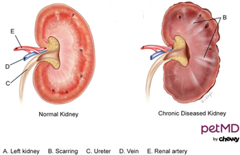 Chronic Kidney Disease