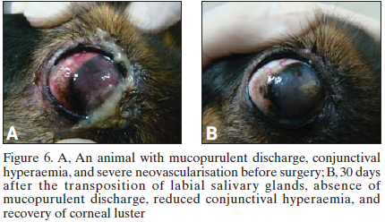 Labial salivary glands transplantation.