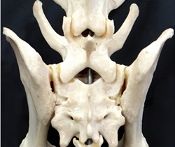 Lumbosacral Joint