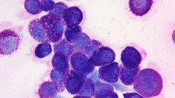 Mast Cells