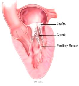 Mitral Valve Cross-Section  Copyright © Cleveland Clinic