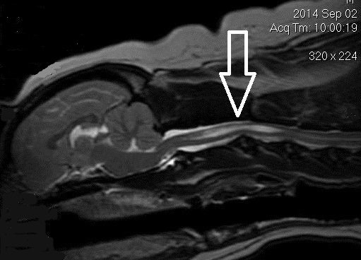 MRI scan of CKCS showing syrinx