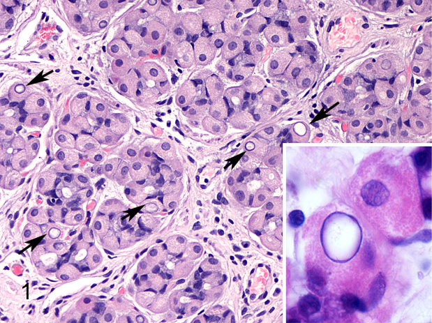 Nuclear glycogen inclusions in gastric glands' cells