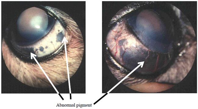 Ocular Melanosis