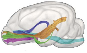 Olfactory Tracts