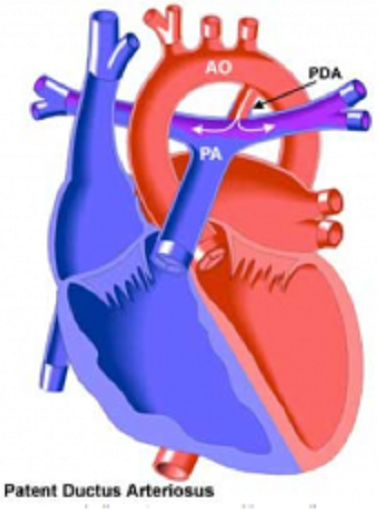 PDA diagram