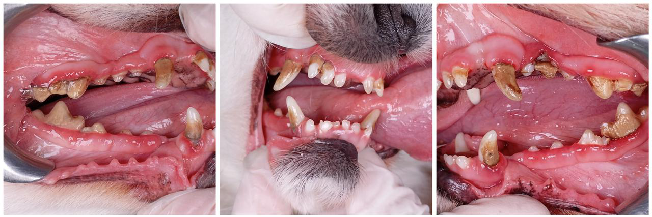 Periodontal Before