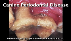 Periodontitis