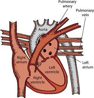 Pulmonary arteries