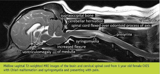 MRI of CKCS with CM & SM