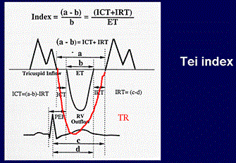 The Tei Index (RVTX)