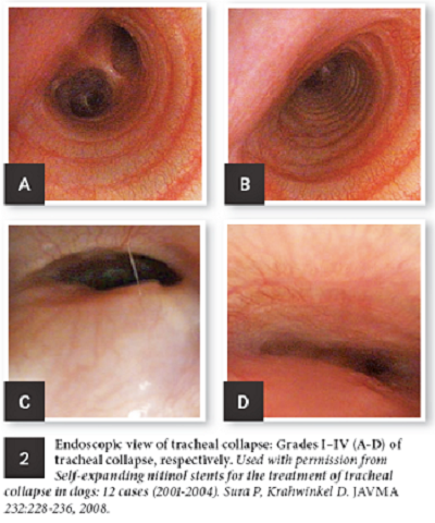 Grades of tracheal collapse