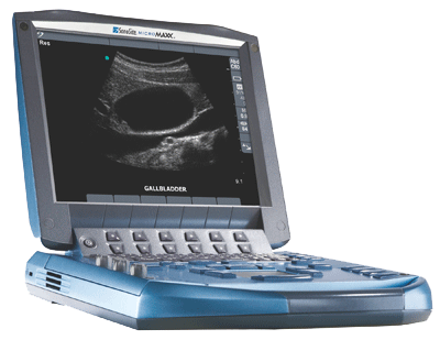 Ultrasound