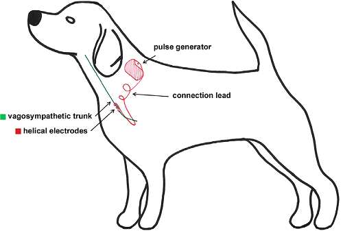 VNS Implant Diagram